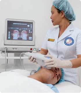 Căng da mặt, cổ, vùng ngực trên... không phẫu thuật bằng công nghệ ULTHERAPY