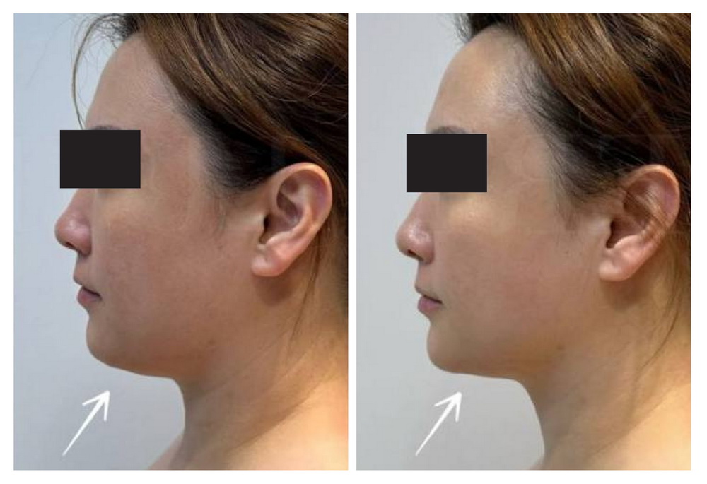 SÁNG DA - MƯỢT DA - SĂN CHẮC DA