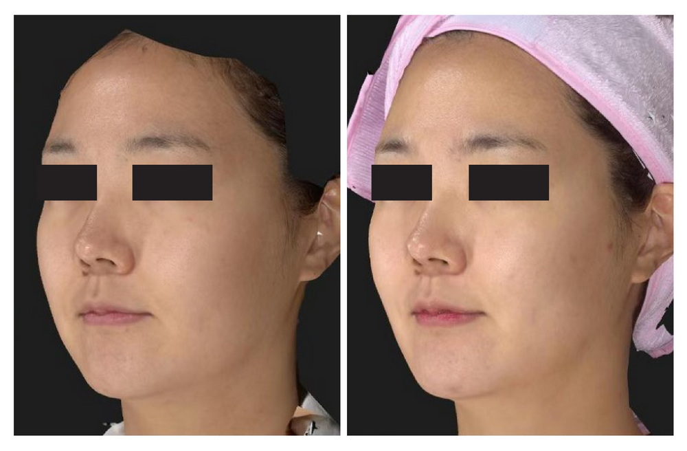 SÁNG DA - MƯỢT DA - SĂN CHẮC DA