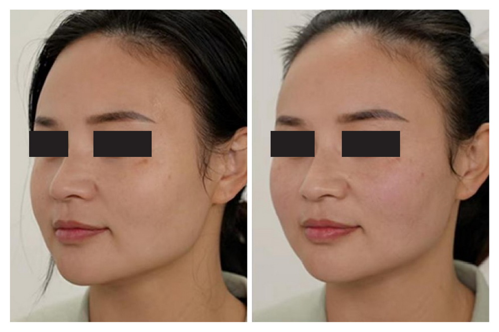 SÁNG DA - MƯỢT DA - SĂN CHẮC DA