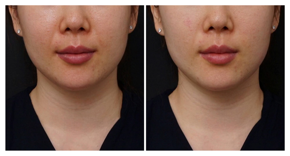 SÁNG DA - MƯỢT DA - SĂN CHẮC DA